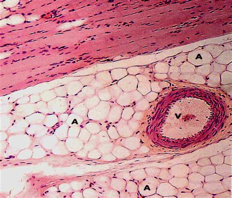 Adipose tissue is a loose fibrous connective tissue packed with many fat cells called adipocytes. lab practical- tissues - Anatomy & Physiology 2093c with ...
