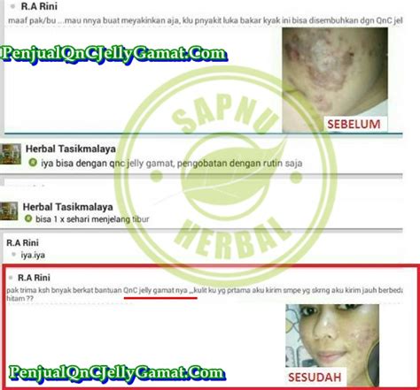 Penyebabnya adalah karena mencukur bulu kaki secara tidak benar, entah karena pisau cukur yang tumpul atau lantaran tidak mengapilaksikan pelembap terlebih dahulu sebelum bercukur. Cara Menghilangkan Bintik Di Bawah Mata Dan Kelopak Mata ...
