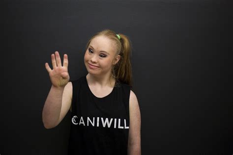 Teen With Downs Syndrome And ‘stunning Brunette With Bionic Arm Walk