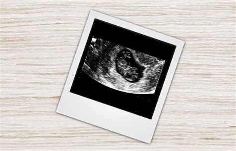 7 Week Sonograms Hiccups Pregnancy