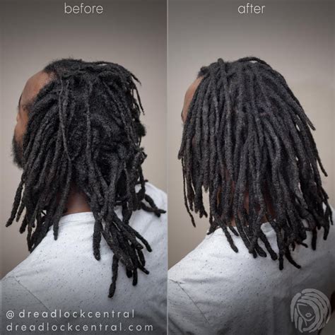 How To Cover Bald Spots With Dreads Ella Scholten Coiffure