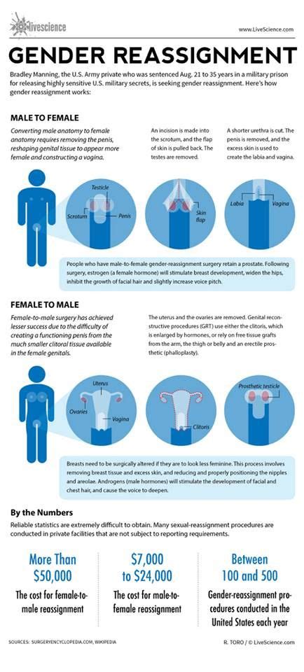 Gender Reassignment Procedure Summary Dont Assume That Just Because Someone Is Transgender