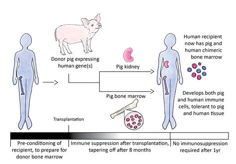 Xenotransplantation Can Pigs Save Human Lives Science In The News