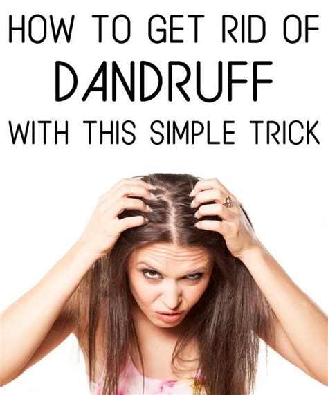 How To Get Rid Of Dandruff With This Simple Trick