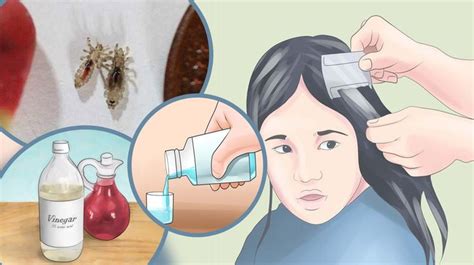 An Easy And Most Effective Way To Remove Head Lice A Trick Hidden By