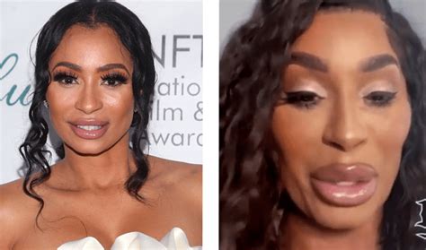 black america responds to karlie redd s new look and trends in plastic surgery