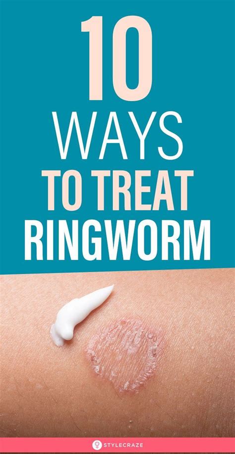 Home Remedies For Ringworms 10 Ways To Treat The Symptoms In 2020