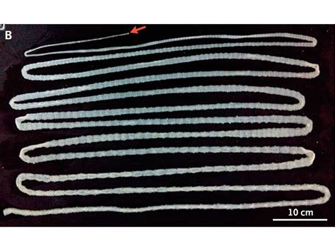 Taenia Tapeworm Segment