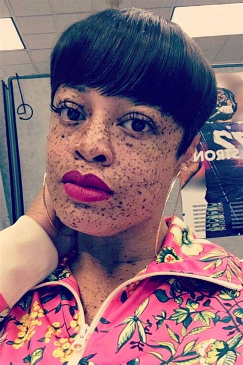 26 Beautiful Black Women Flaunting Their Freckles Women With Freckles Beautiful Freckles