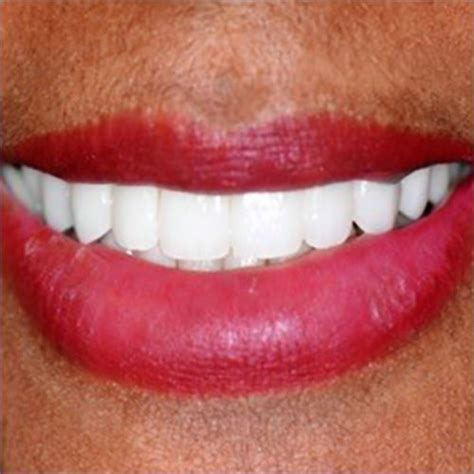 A) offers your family comprehensive dental services with a smile. Home | Barnes Walton Dental Associates | Chicago Illinois