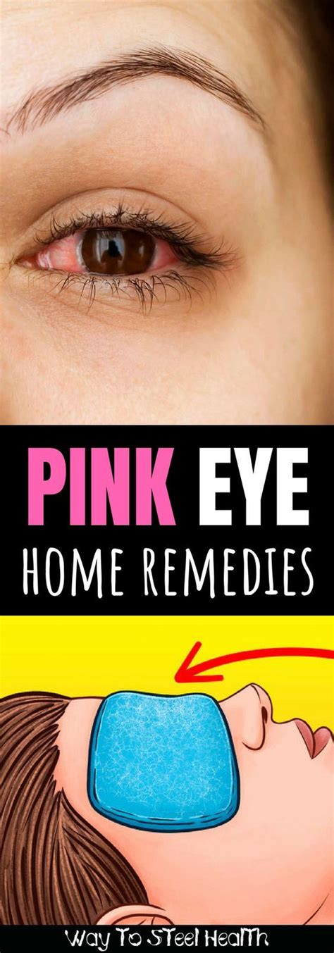 Get Rid Of Pink Eye Fast With These 6 Home Remedies Pink Eye Home