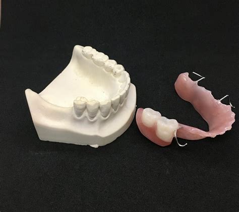 Partial Dentures A Quick And Complete Guide Lb Denture