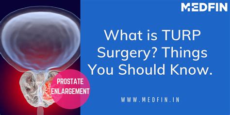 What Is Turp Surgery Things You Should Know Medfin