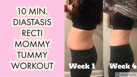 10 Min Mommy Tummy Workout Exercises To Heal Diastasis Recti Youtube