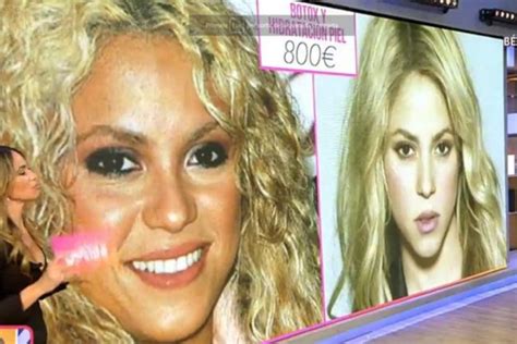 Shakira Before And After
