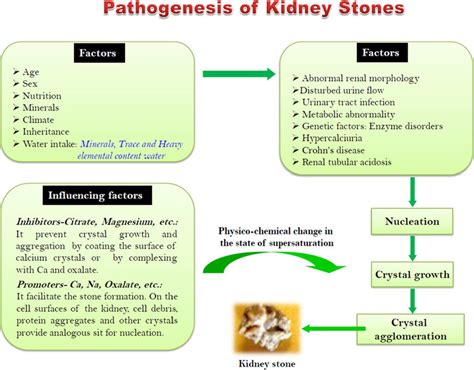 General Concept And Steps In Kidney Stone Formation Download