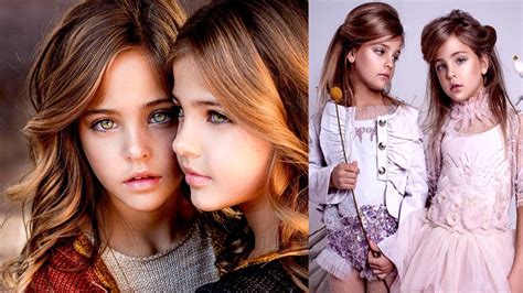 Worlds Most Beautiful Twins Then And Now