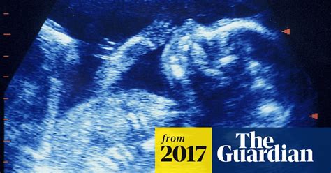 Pregnancy Tests Alleged Link To Birth Defects To Be Reviewed By Uk