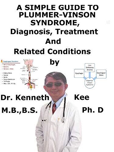 A Simple Guide To Plummer Vinson Syndrome Diagnosis Treatment And