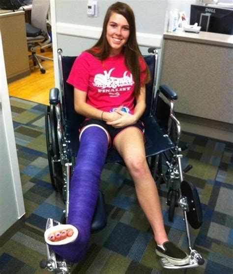 Broken Leg Ankle Cast Long Leg Cast Medical Art It Cast Lady