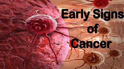 Early Signs Of Cancer In Your Body You Must Know About Youtube