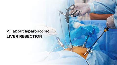 Everything You Need To Know About Laparoscopic Liver Resection Ailbs India