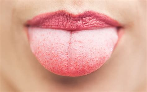 Keeping Your Tongue Healthy 32 Watts Blog