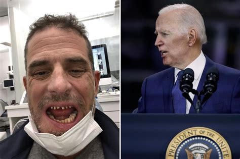 Cynical Defense Of Hunter Biden I Was Addicted To Drugs