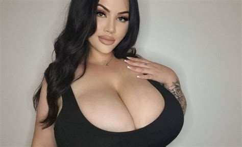 Woman S Rare Condition Causes Breasts To Grow Four Bra Cup Sizes In One