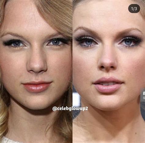 Taylor Swift New Nose Cirugia Plastica De Nariz Rinoplastia Cirujia De Nariz