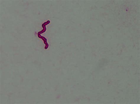 Single Spirochete From A Morgellons Disease Skin Specimen Immunostained