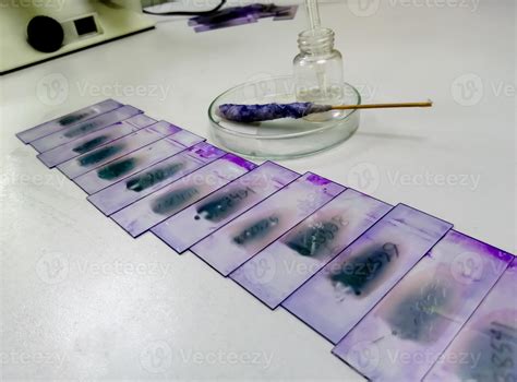 Stained Glass Slides Of Peripheral Blood Smear With Violet Leishman Giemsa Stain Is Isolated In