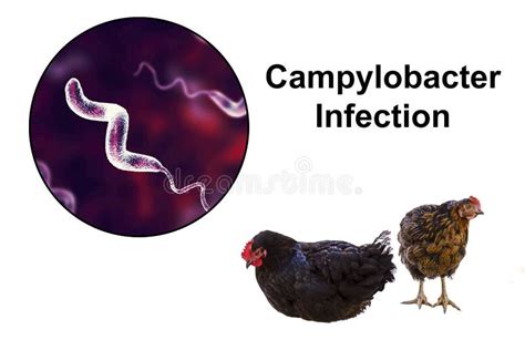Chicken As The Source Of Campylobacter Infection Stock Image Image Of