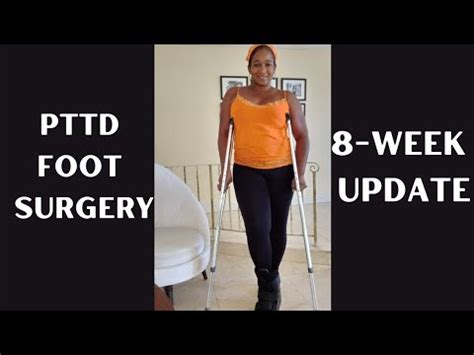 PTTD Foot Surgery Update Week Post Op YouTube