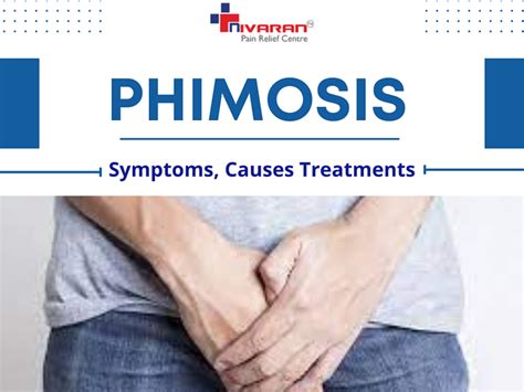 Phimosis Symptoms Causes And Treatments By Nivaran Hospital On Dribbble