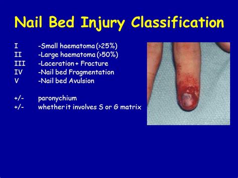 Haematoma Nail Bed How To Heal