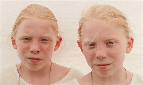 Identical Twins ARE Genetically Different As Study Shows Their DNA Changes In The Womb