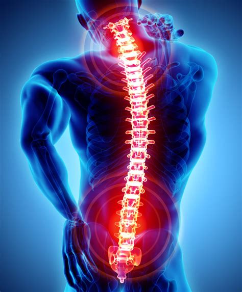 Conditions We Treat Frisco Spine