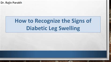 Ppt How To Recognize The Signs Of Diabetic Leg Swelling Powerpoint