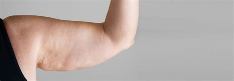 How To Reduce The Cellulite On The Arms With Icoone Icoone