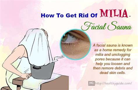 Home Remedy For Milia Cysts Homemade Ftempo