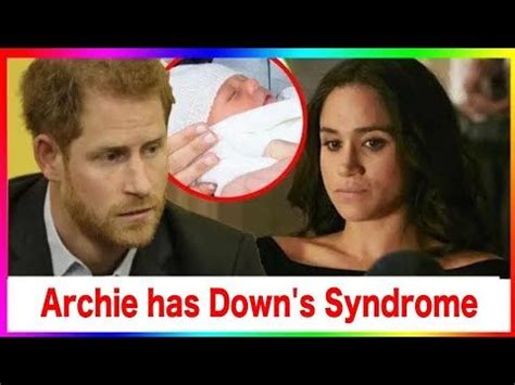 Meghan collapsed because she could not hide this bad thing! Prince Archie has Down syndrome! Harry and Meghan can not ...