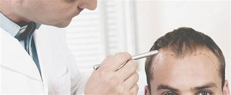 Al fixes a receding hairline with hair illusion in this easy to follow tutorial. Can A Hair Transplant Restore Receding Temples & Hairline ...