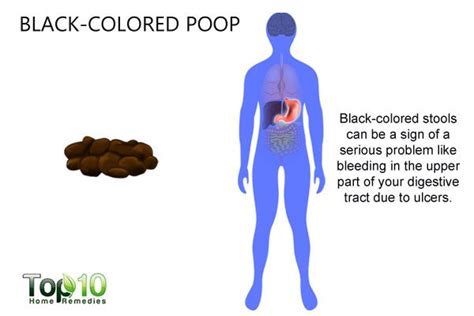 What Your Poop Says About Your Health Top 10 Home Remedies