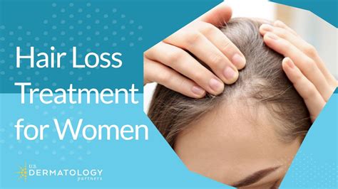Hair Loss Treatment For Women Youtube