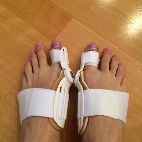 Advantages Of Wearing Bunion Friendly Shoes