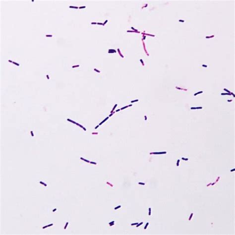 Microscopic Visualization Of Bacillus Cereus Examined Under Light