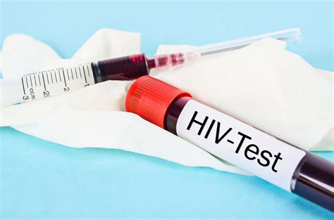 Test Na Hiv Jak Wygl Da Badanie Na Hiv I Gdzie Je Wykona The