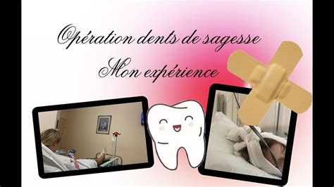 Mon Exp Rience Suite Mon Op Ration Des Dents De Sagesse Je R Ponds Vos Questions Youtube