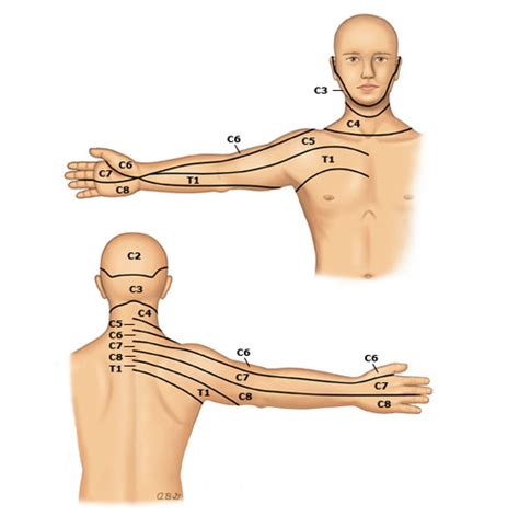 Cervical Radiculopathy Lumbar Myotomes Flashcards Quizlet The Best